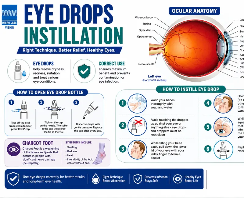 Eye Drop Instillation: The Right Way to Use Eye Drops